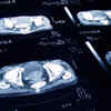 Ways to prevent your risk of developing prostate cancer
