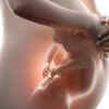 ​Is there no fetal movement in such pregnancies?