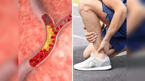 Warning sign in the leg when exercising