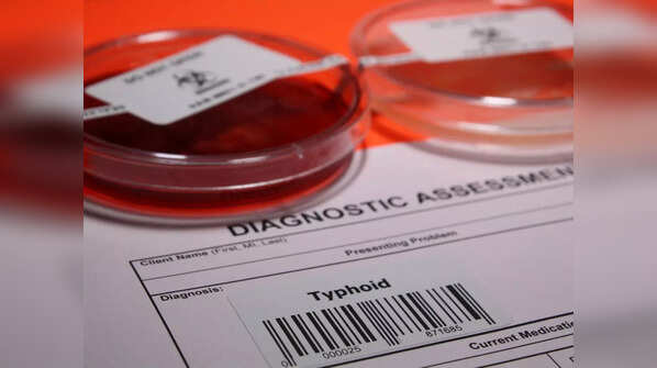 How to know whether you have typhoid or dengue?