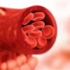Venous thromboembolism is a big risk