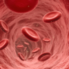 ​COVID is associated with strokes​