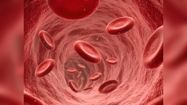 COVID is associated with strokes