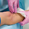 ​MYTH: People with diabetes go blind and lose their legs
