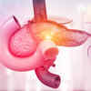 ​Is Pancreatic cancer easily detectable?