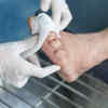 Diabetic foot ulcer warning sign