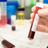 ​Blood transfusion​