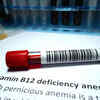 Do not wait - get yourself tested