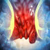 ​​First symptom that Seymour spotted