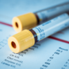 ​How does not remaining in fasting affect the blood test report?