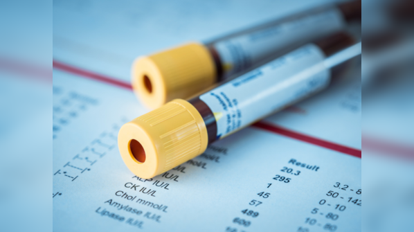 How does not remaining in fasting affect the blood test report?