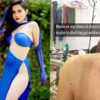Urfi Javed gets badly bruised after experimenting with a new outfit