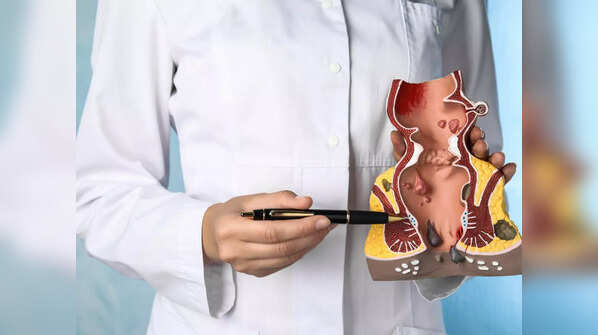 Colonoscopy