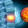 ​What are the symptoms associated with Chordoma?