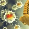 ​What is Chordoma?