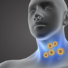 ​Is this a strong predictor of COVID?