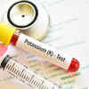 How to check if you have low levels of potassium in the body