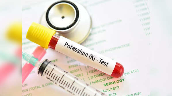 How to check if you have low levels of potassium in the body