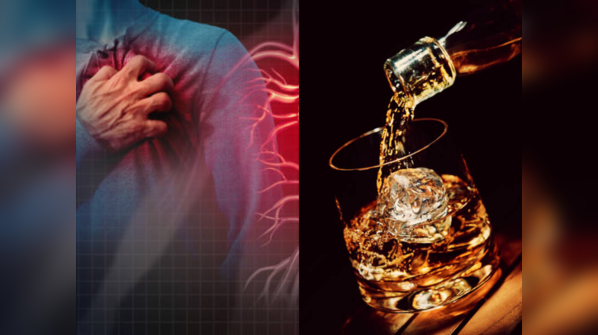It is also known as alcohol-induced atrial arrhythmias