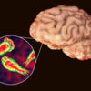 ​Brain eating amoeba in india