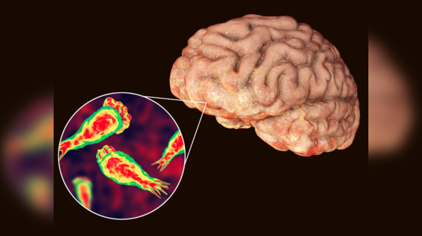 Brain eating amoeba in india