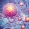 ​Ataxia is the result of cancerous growth in…