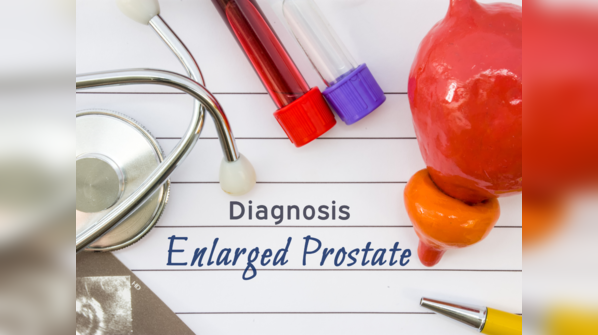 Understanding the prostate gland