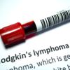 ​Hodgkin Lymphoma diagnosis