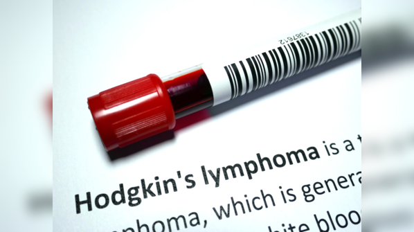 Hodgkin Lymphoma diagnosis
