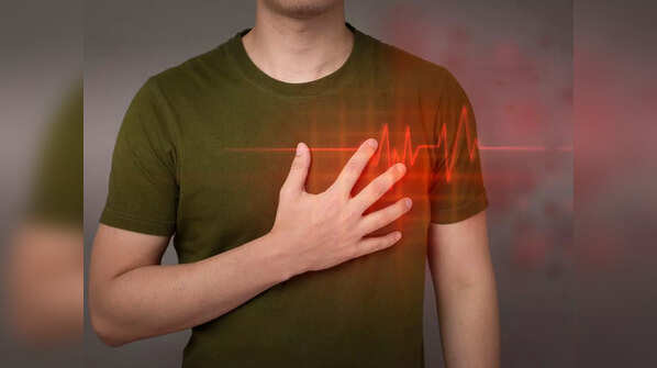 Heart attack