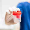 ​Your urine is foamy
