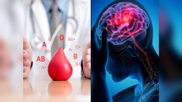 What your blood type says about stroke risk