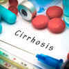 Symptoms of cirrhosis