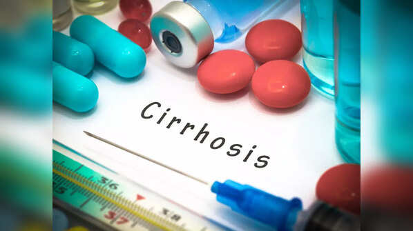 Symptoms of cirrhosis