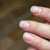 One common sign found in your fingers