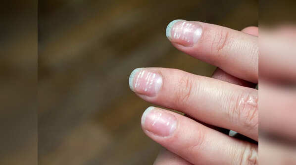 One common sign found in your fingers