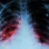 ​How risky is this health condition?
