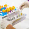 Blood in urine
