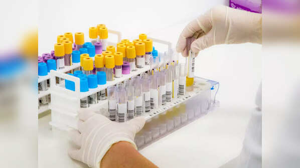 Blood in urine
