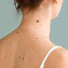 Changes in mole