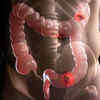 Change in bowel habits