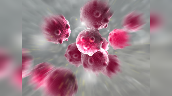 <strong>What are the symptoms of stomach cancer? </strong>