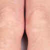 Skin problems