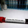Why regular screenings is necessary