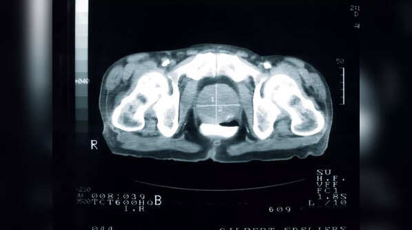 Urinary problems may not be the only symptoms