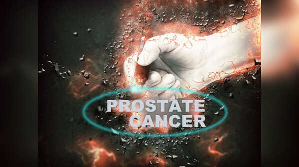 Most common symptoms of prostate cancer