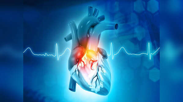 Blockage in or around her heart