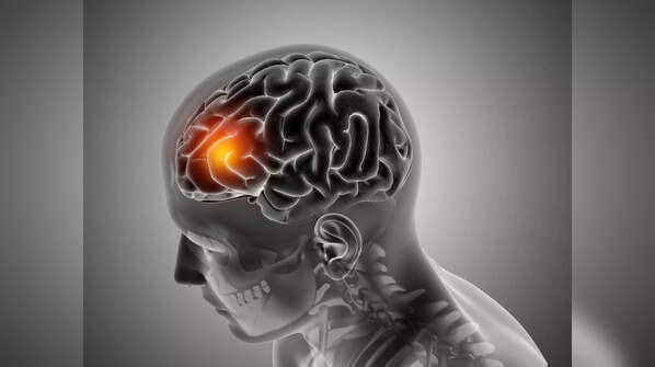 Signs of brain tumour