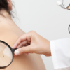 Melanoma diagnosis