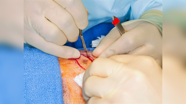 Surgery and monitoring